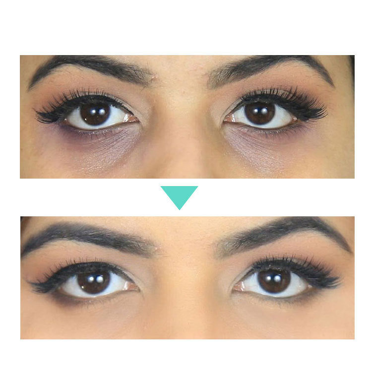 DarkCircle & Puffiness Eye Cream