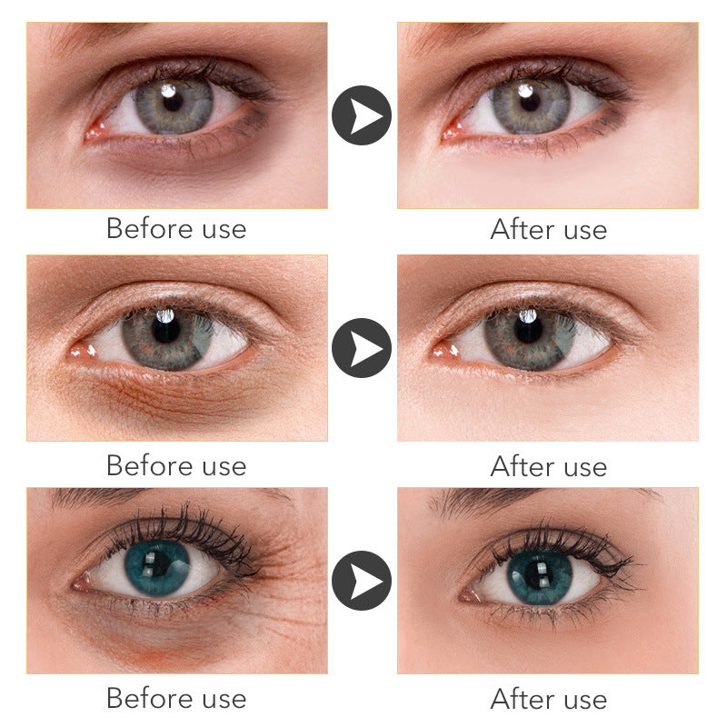 DarkCircle & Puffiness Eye Cream