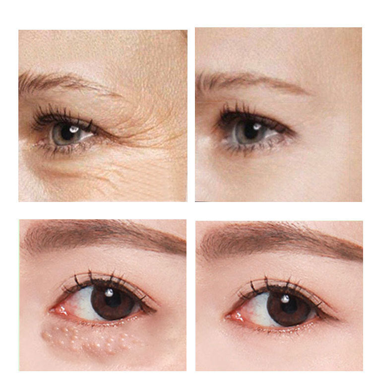 DarkCircle & Puffiness Eye Cream